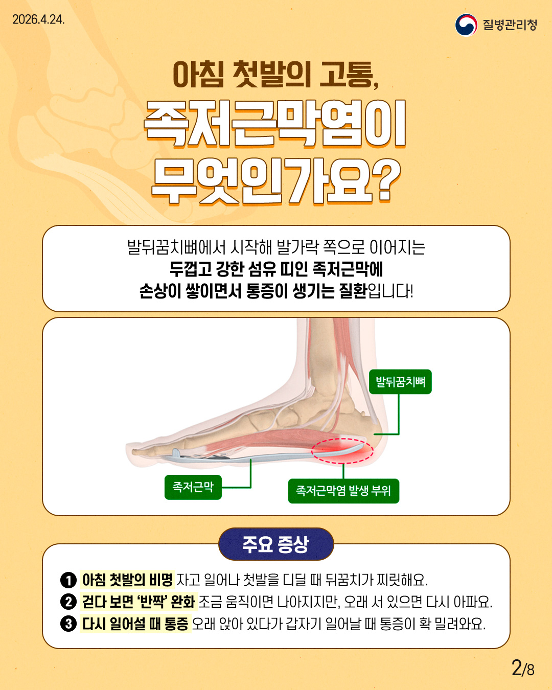 아침 첫발의 고통, 족저근막염이 무엇인가요? 발뒤꿈치뼈에서 시작해 발가락 쪽으로 이어지는 두껍고 강한 섬유 띠인 족저근막에 손상이 쌓이면서 통증이 생기는 질환입니다! 주요 증상 1. 아침 첫발의 비명 자고 일어나 첫발을 디딜 때 뒤꿈치가 찌릿해요. 2. 걷다 보면 '반짝' 완화 조금 움직이면 나아지지만, 오래 서 있으면 다시 아파요. 3. 다시 일어설 때 통증 오래 앉아 있다가 갑자기 일어날 때 통증이 확 밀려와요.